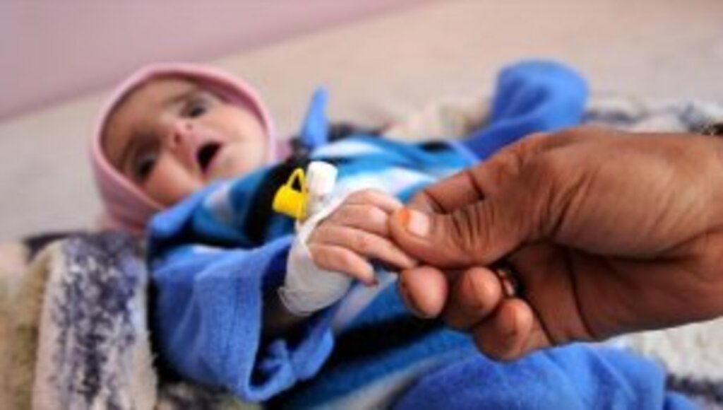 Yemen'de 12 milyon çocuk acil yardıma muhtaç