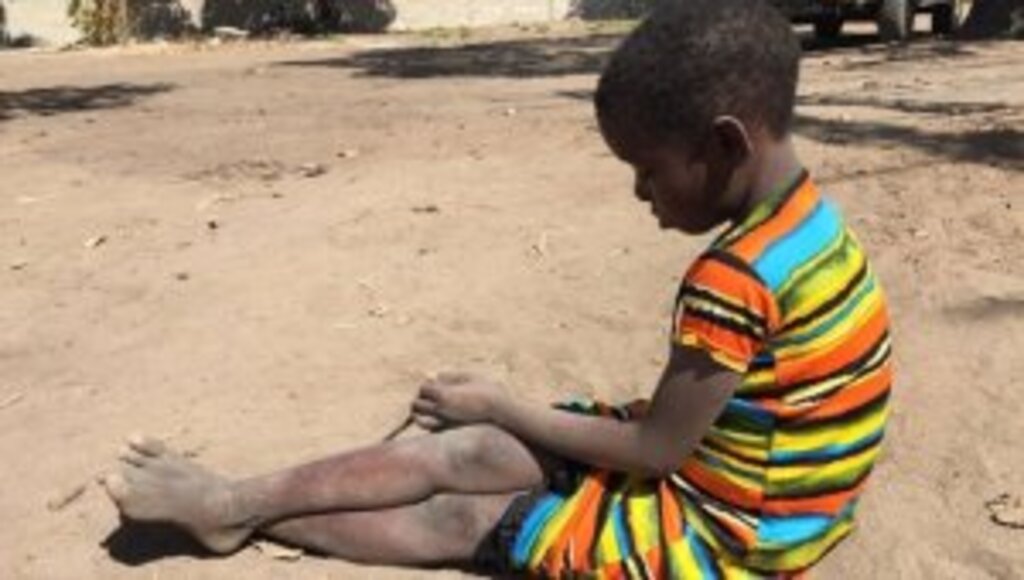 İsraf edilen 1,3 milyar ton gıda 821 milyon aç insanı doyurabilir