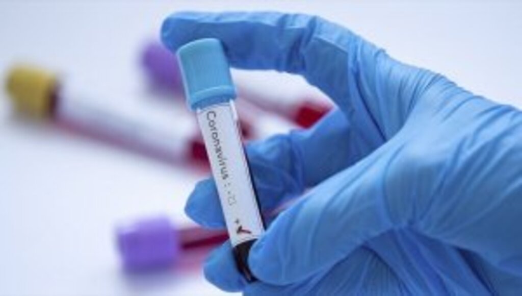 Kan grubu A olanlarda Kovid-19 görülme olasılığı daha yüksek