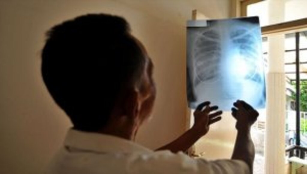 DSÖ'nün Dünya Tüberküloz Günü temasında "yatırım yapın hayatları kurtarın" vurgusu