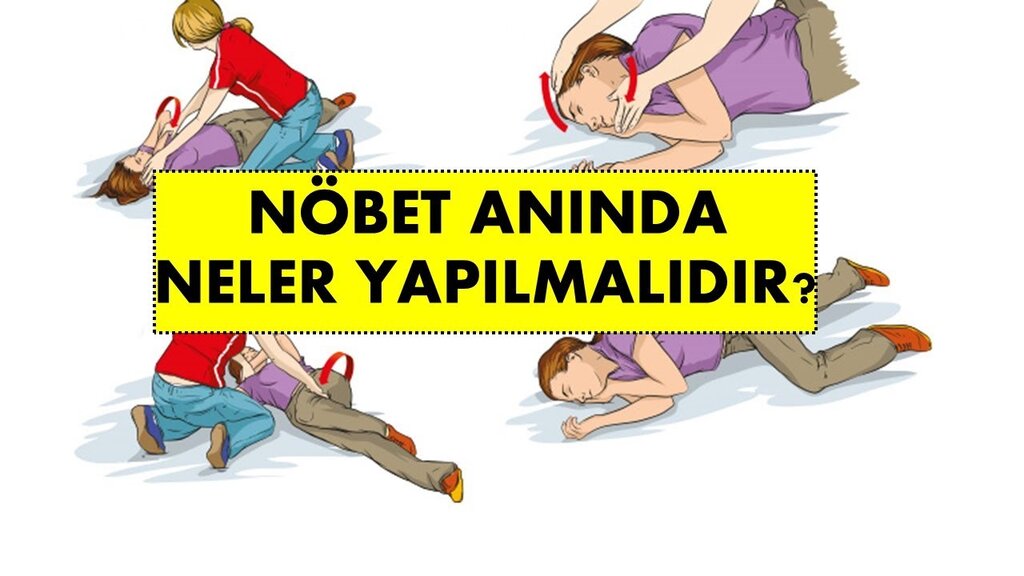 Epilepsi Nöbeti Geçirmemek İçin Ne Yapmalı