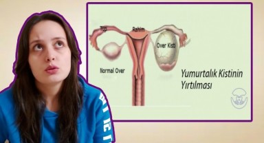 Yumurtalık Kisti Belirtileri Nasıl Anlaşılır