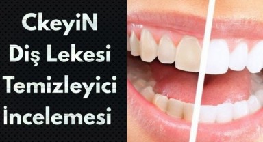 Siyah Diş Lekeleri Evde Nasıl Temizlenir