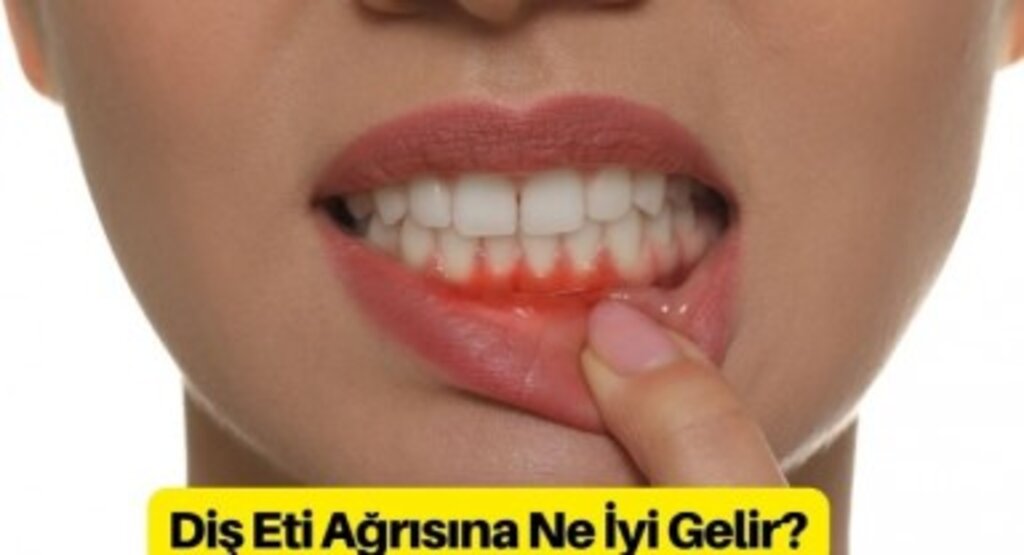Diş Eti Ağrısı Nasıl Geçer Kesin Çözüm