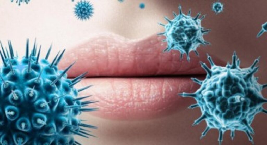 Herpes Virüsü Vücuttan Nasıl Atılır