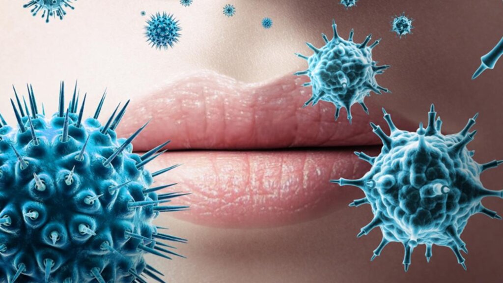 Herpes Virüsü Vücuttan Nasıl Atılır