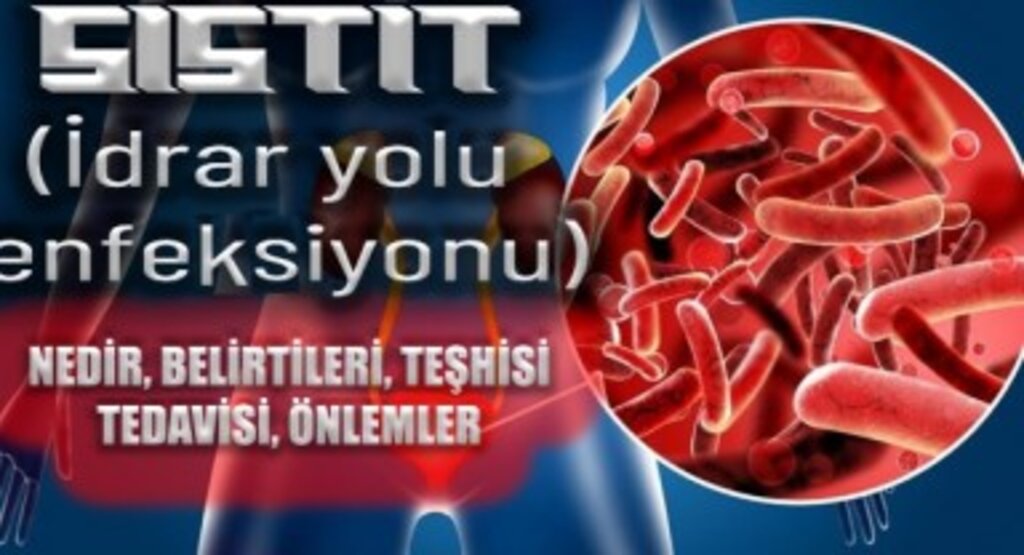 İdrar Yolu Enfeksiyonu Nasıl Anlaşılır