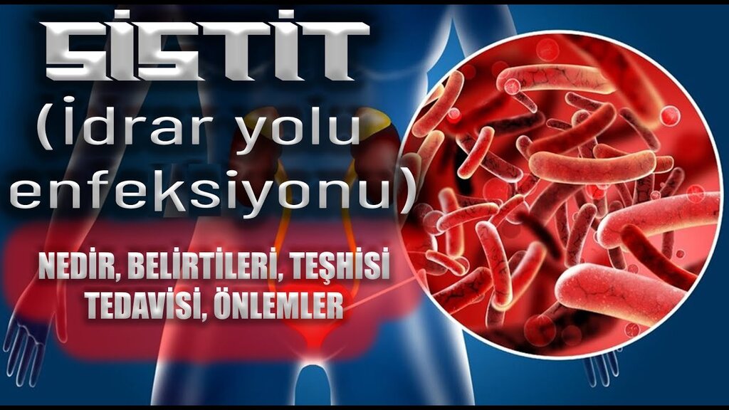 İdrar Yolu Enfeksiyonu Nasıl Anlaşılır