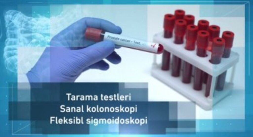 Kolon Kanseri Testi Evde Nasıl Yapılır