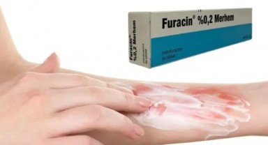 Furacin 0 2 Merhem Ne İçin Kullanılır
