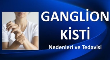 Ganglion Kisti Evde Nasıl Tedavi Edilir