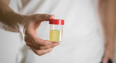 Kadınlarda İdrar Kokusu Nasıl Giderilir